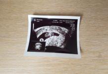 Schwangerschaftstest Online auf Familie & Kind
